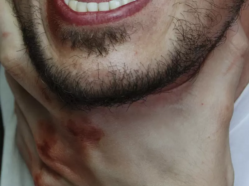 Hombre siendo asfixiado