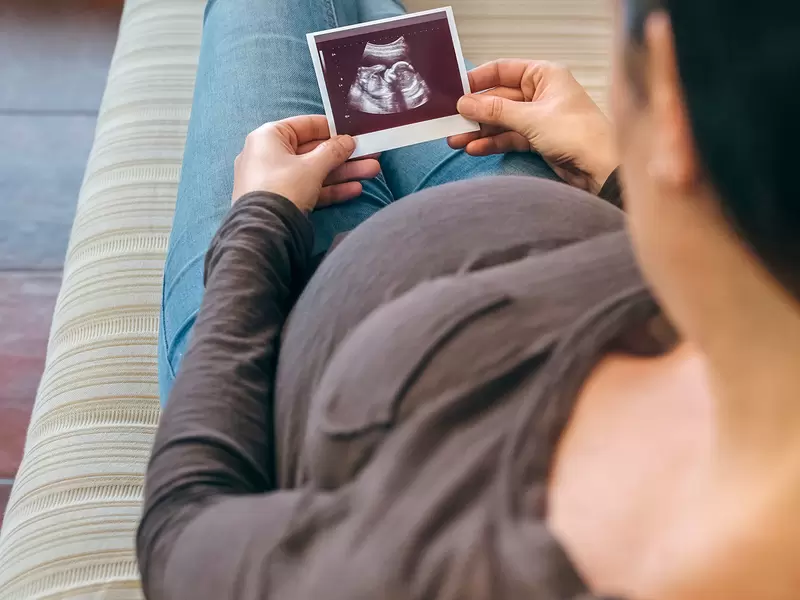 Foto de referencia sobre el aborto