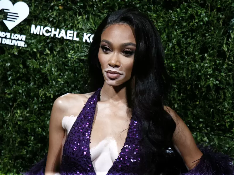 Winnie Harlow