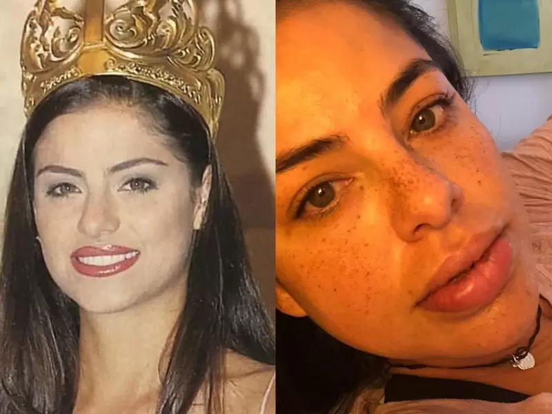 Antes y después de Catalina Acosta Antes y después de Catalina Acosta