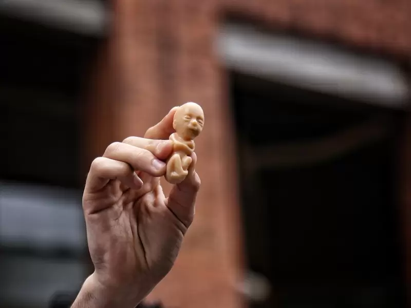 Aborto en Colombia