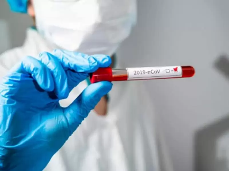 Prueba de coronavirus