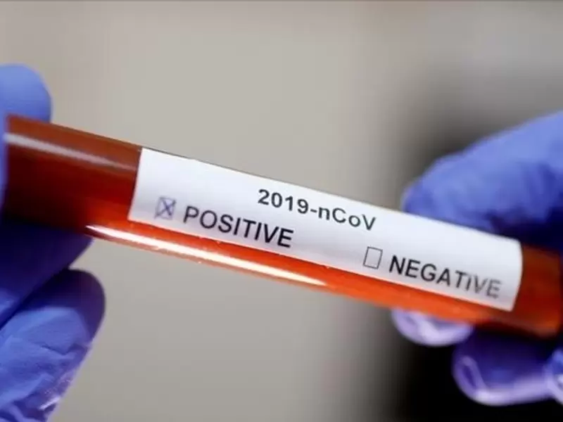 Pruebas de coronavirus en Colombia