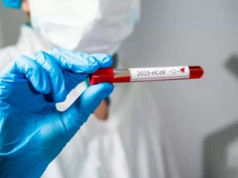 Por ahora se recurrirá a los laboratorios biomoleculares.