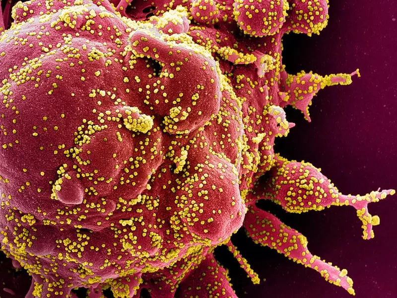 Descubren cómo el virus SARS-CoV-2 se comunica con las células humanas |  RCN Radio