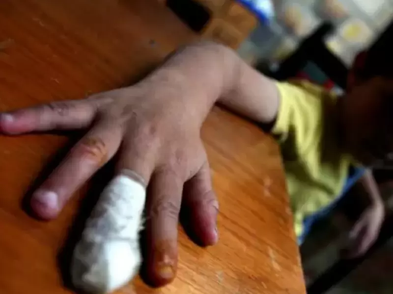 Quemados pólvora