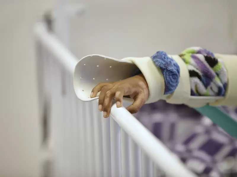 Quemado con pólvora Quemado con pólvora