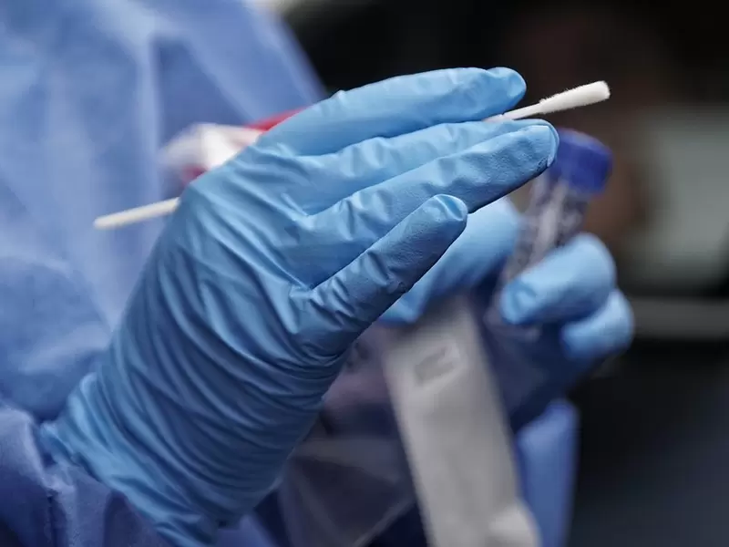 Prueba de coronavirus Prueba de coronavirus