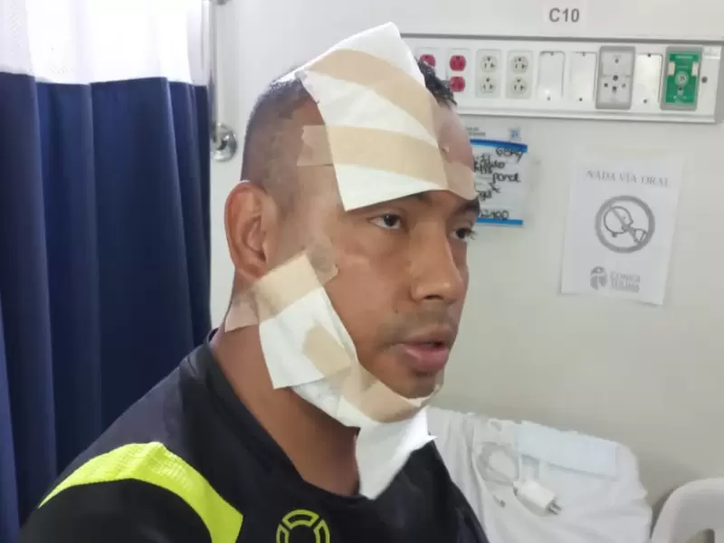 Patrullero de la Policía atacado con ácido en Ibagué.
