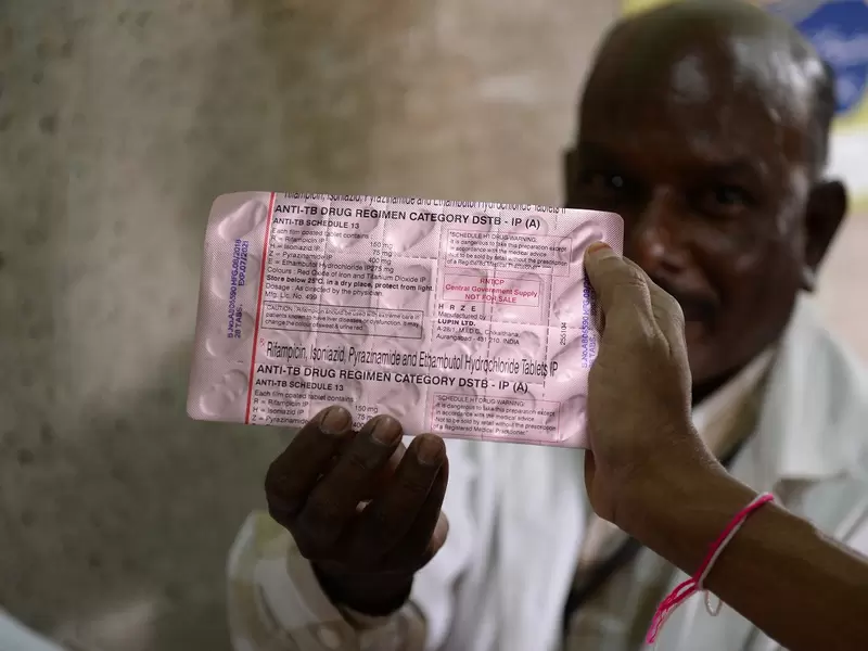 Tuberculosis