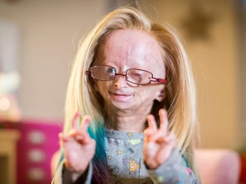 Adalia Rose Adalia Rose