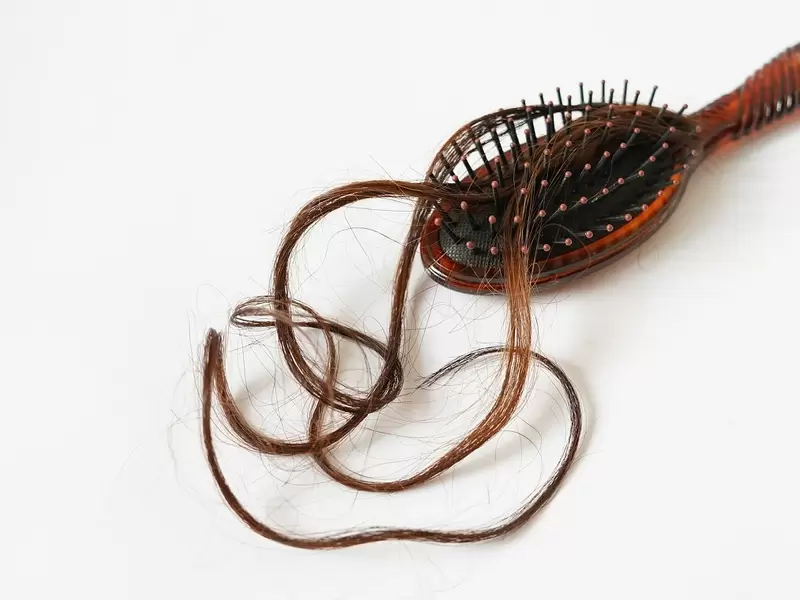 Alopecia