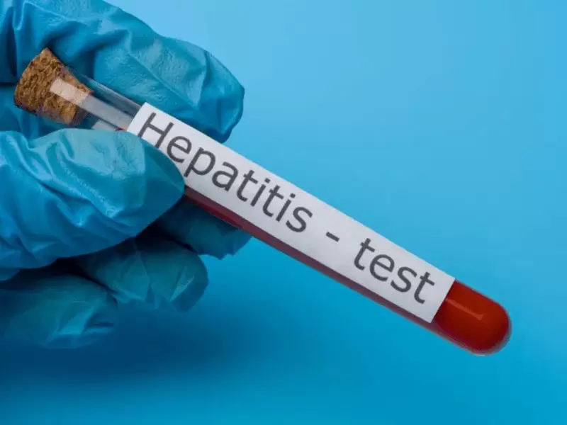 Hepatitis en Cartagena