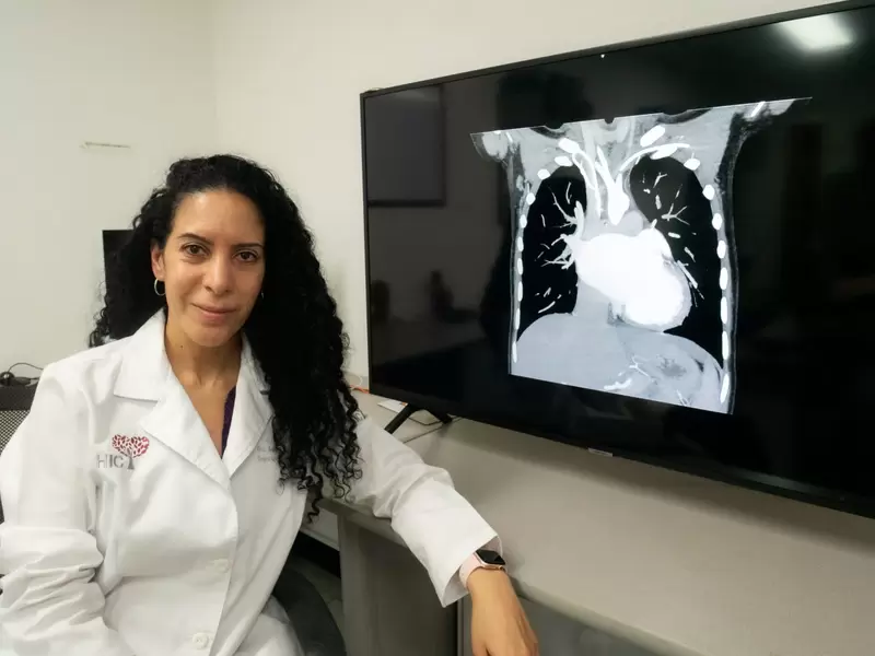 Sara Mendoza: la primera mujer en implantar un corazón artificial en Latinoamérica