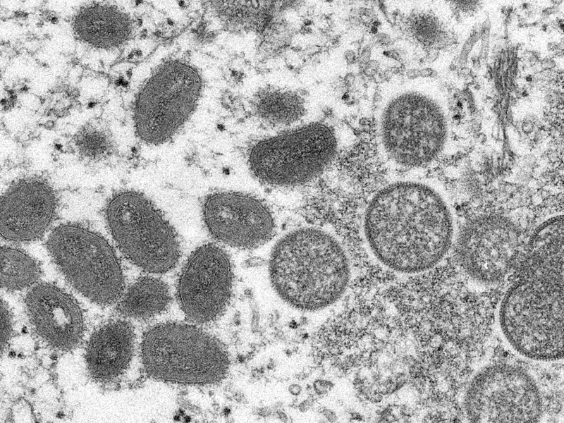 Virus de la viruela del mono