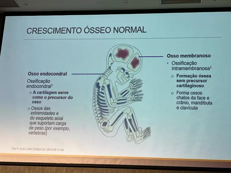 La acondroplasia es una enfermedad huérfana.