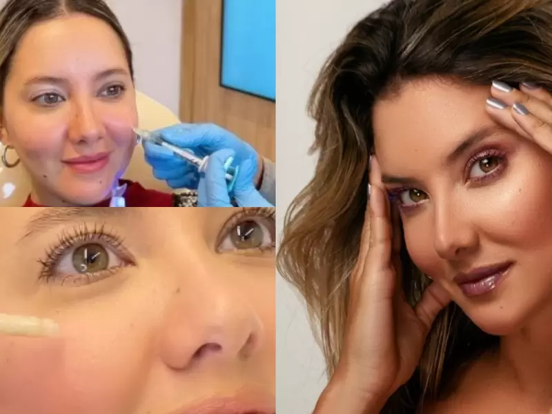 Daniella Álvarez se quemó la cara