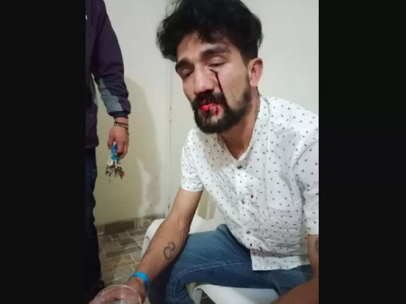 Kundaly Gómez, quien denunció una golpiza en la discoteca Theatron.