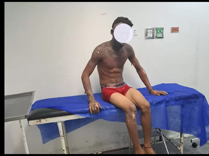 Sujeto se electrocuta robando fibra óptica en Barranquilla Sujeto se electrocuta robando fibra óptica en Barranquilla