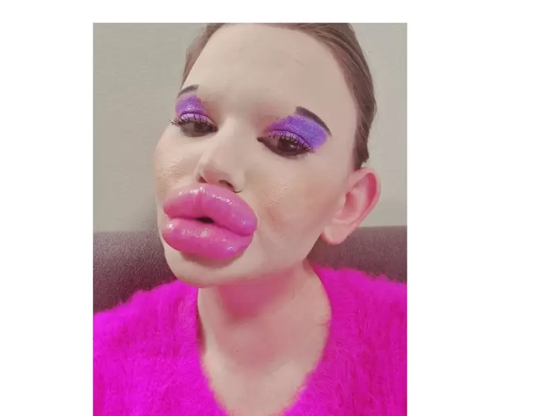 Mujer con los labios más gruesos del mundo no parará con inyecciones Mujer con los labios más gruesos del mundo no parará con inyecciones