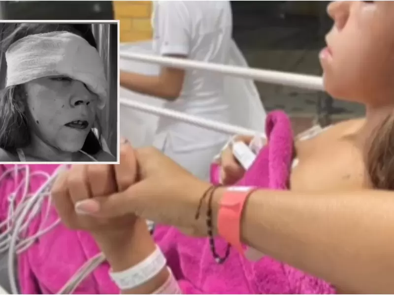 Emily Munera sufrió grave accidente Emily Munera, exparticipante de reality