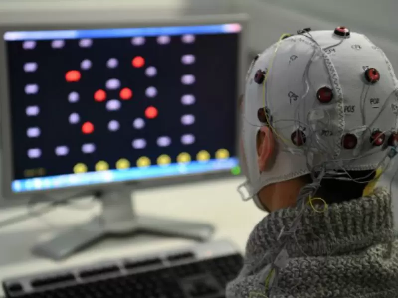 Cerebro Cerebro
