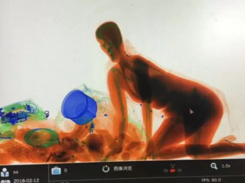 China rayos x China rayos x