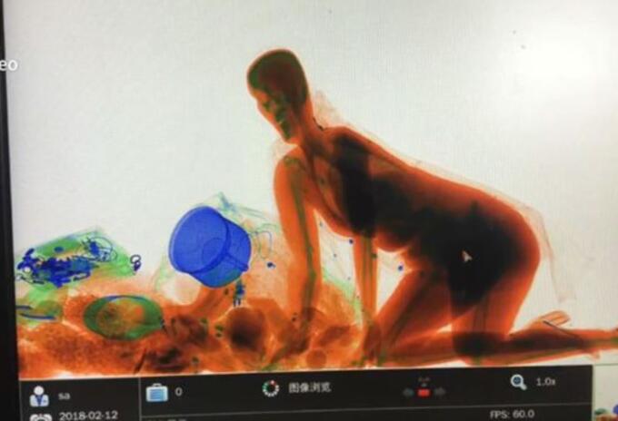 China rayos x China rayos x